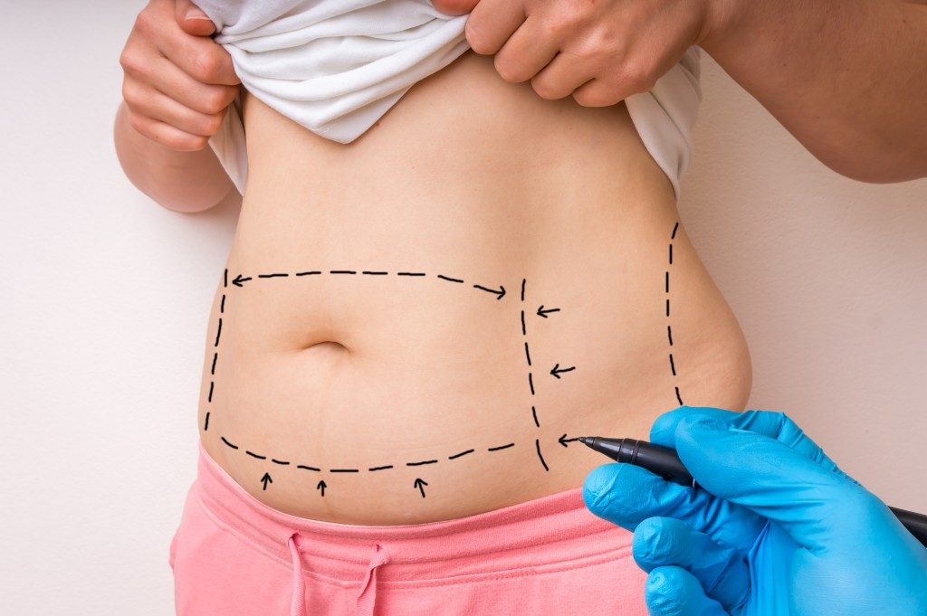 body contouring lines on a woman