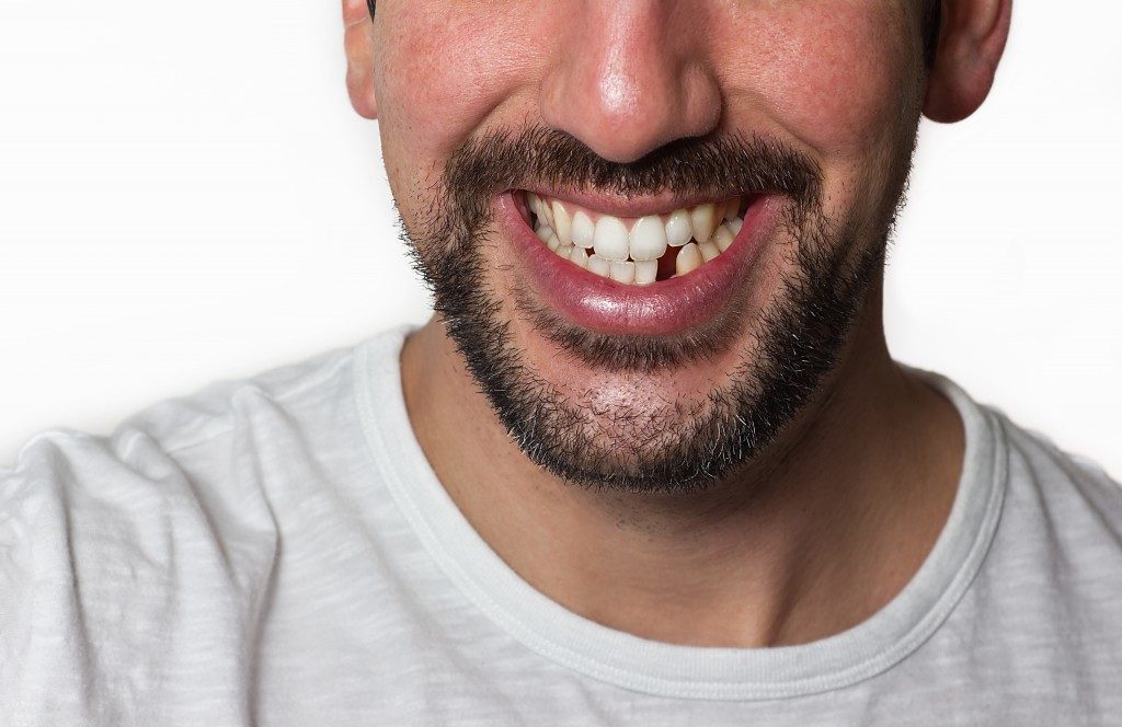 man smiling with a missing tooth