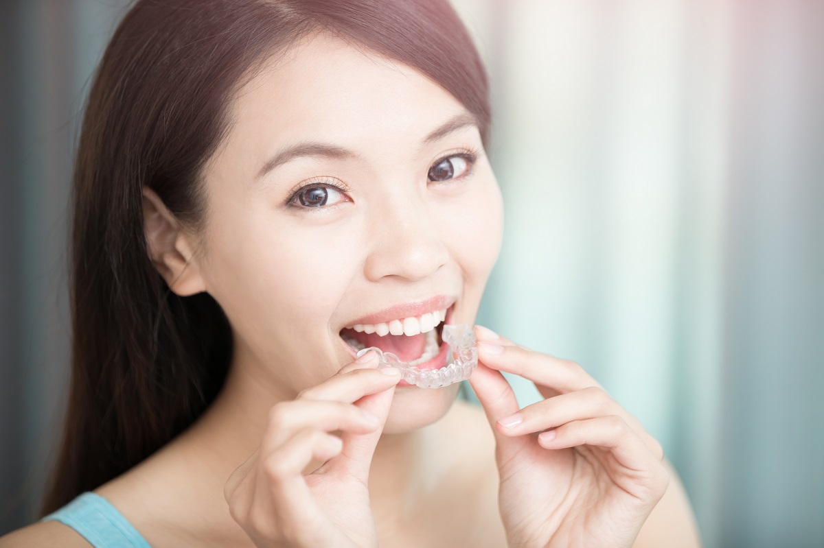 Invisalign: origins, invention and growing popularity