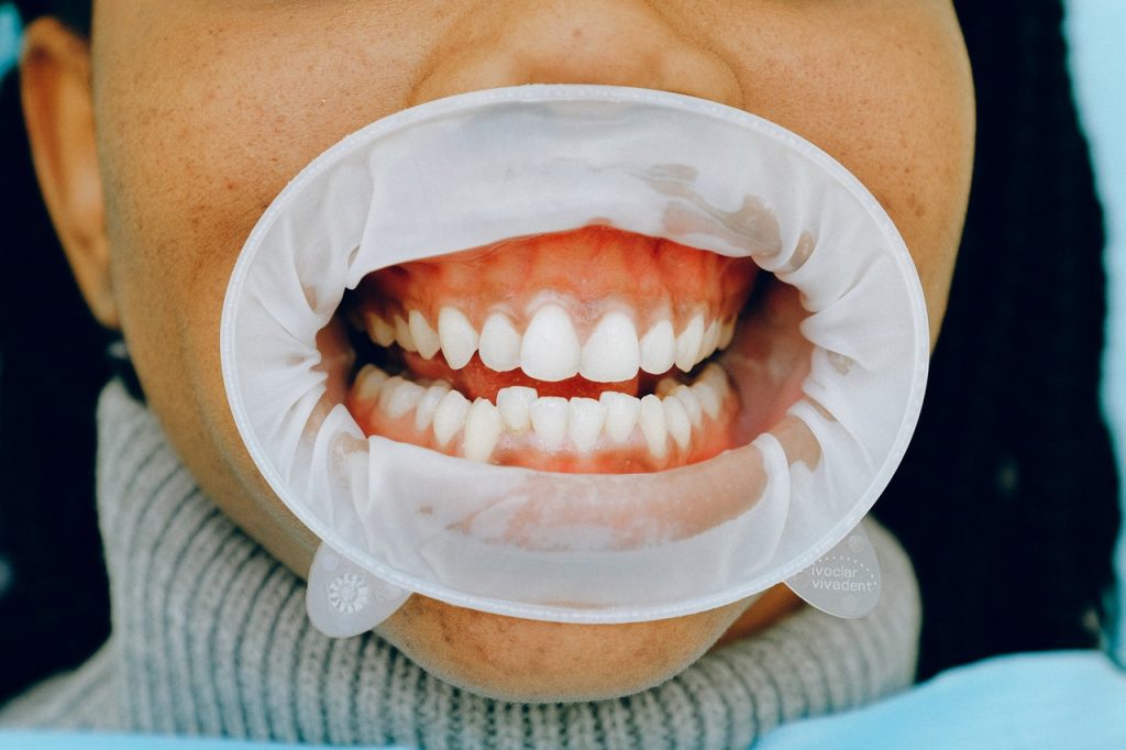 woman gums dentist