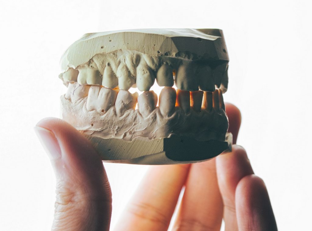 mold of teeth