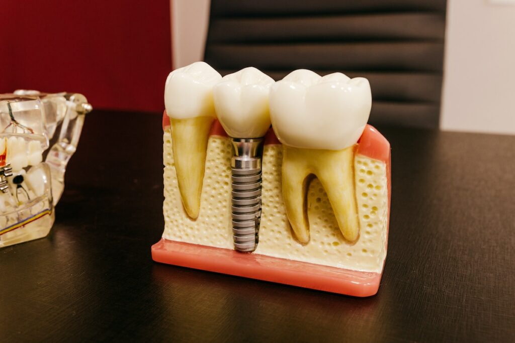 Dental implants with screw on table in clinic