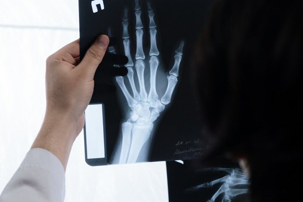 Person Holding a Hand X-Ray